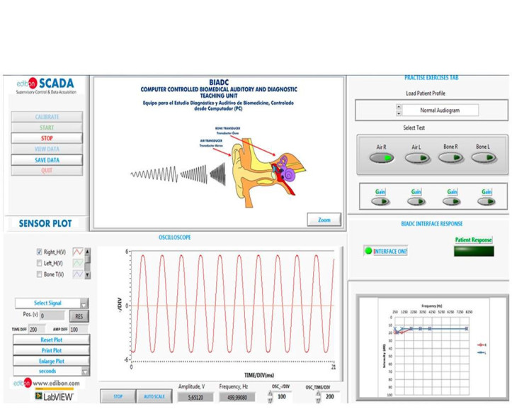 COMPUTER CONTROLLED BIOMEDICAL DIAGNOSIS AND AUDITORY UNIT - BIADC